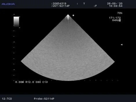 Aloka UST-52114P Convex Probe