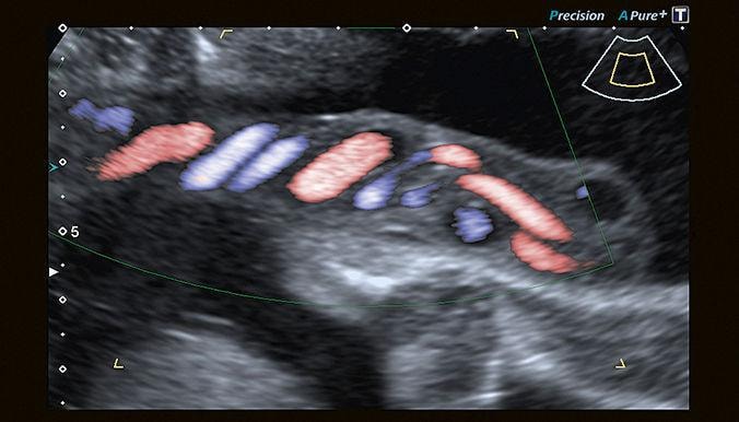 Canon Medical Systems Xario 100G