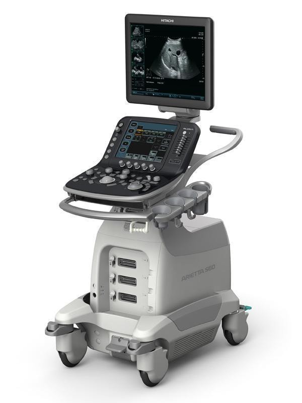 Hitachi ARIETTA S60