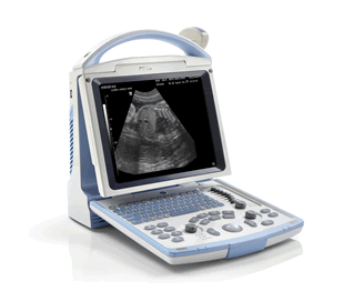 Mindray DP-10 Ultrasound Machine