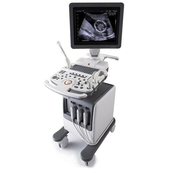 Samsung Medison SonoAce R5