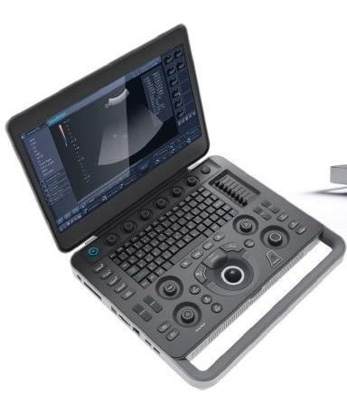 SonoScape X5 Ultrasound Machine
