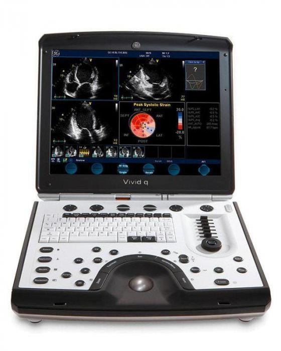 GE HealthCare Vivid Q — صورة 1
