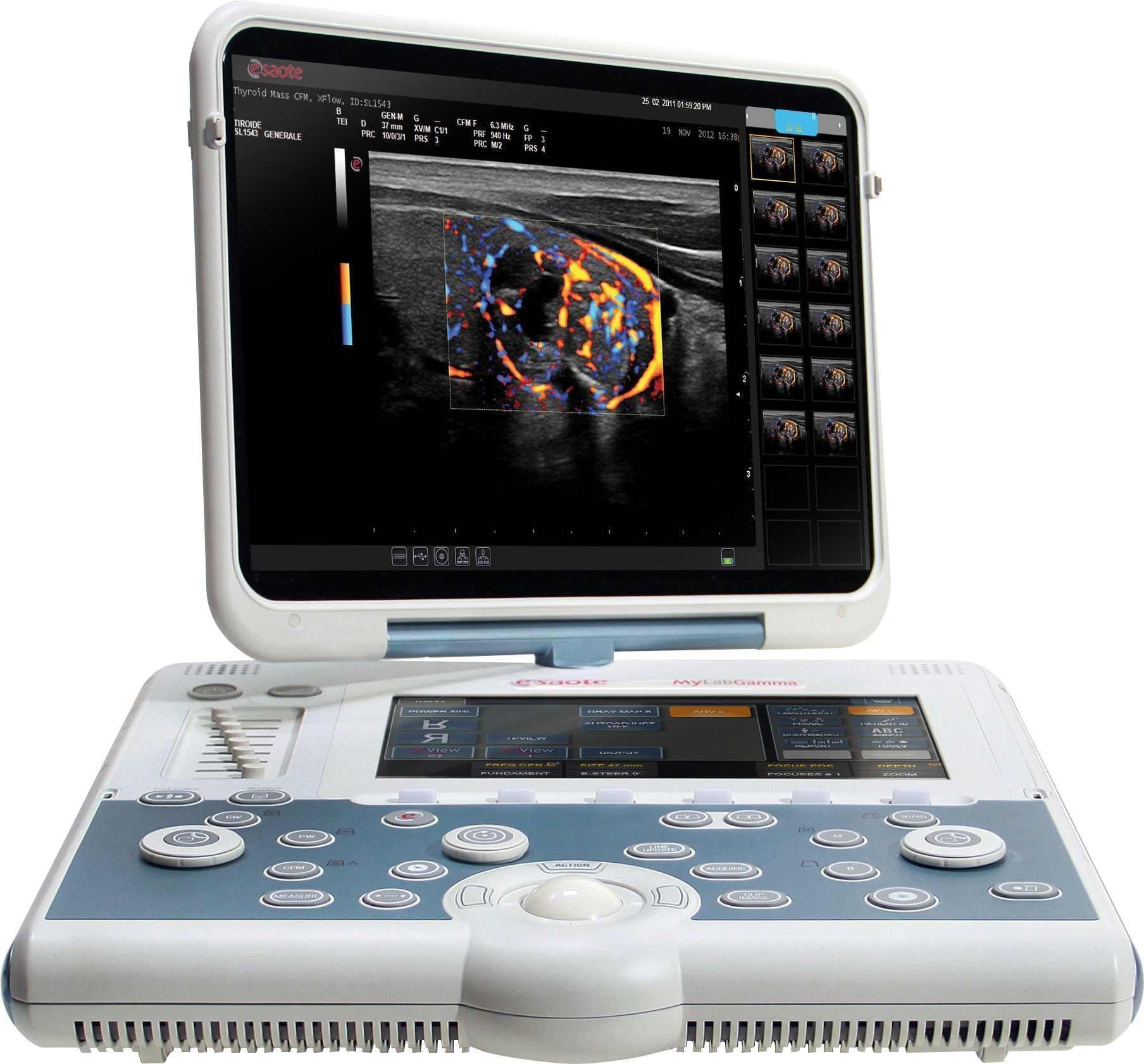 Esaote MyLab Gamma