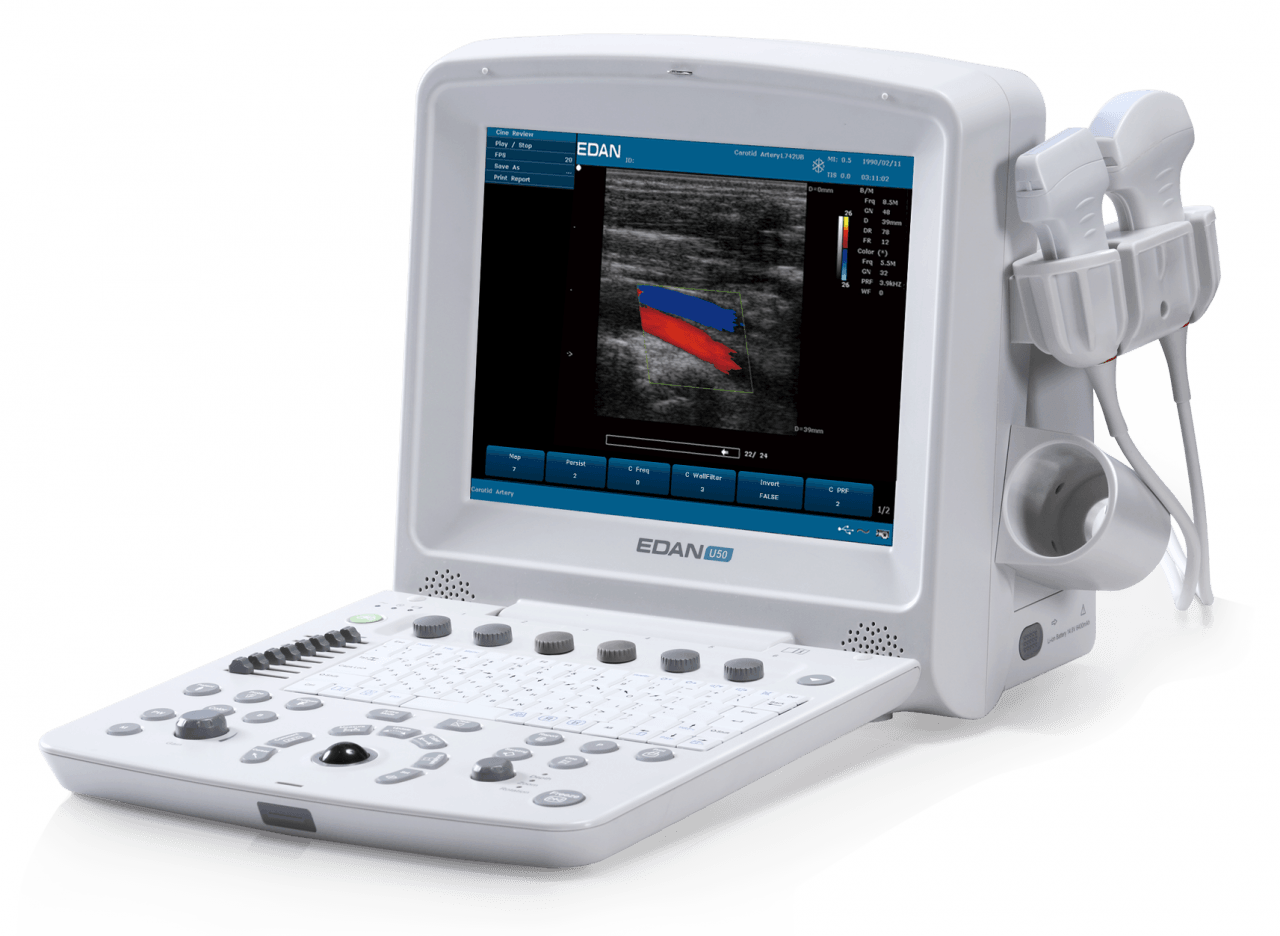Edan U50 Ultrasound Machine