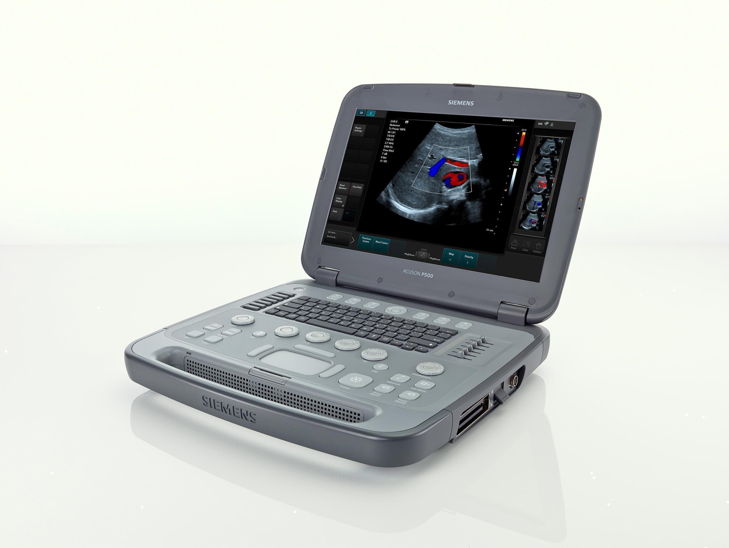 Siemens Healthineers ACUSON P500
