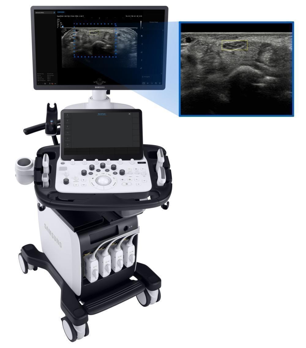 Samsung Medison V8 Ultrasound Machine