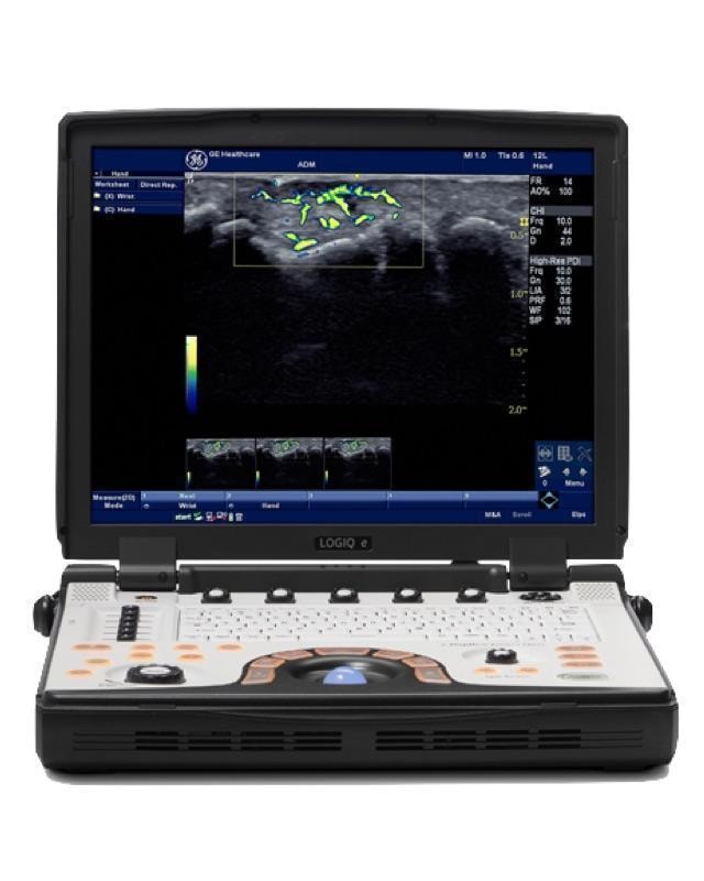 GE HealthCare NextGen LOGIQ e