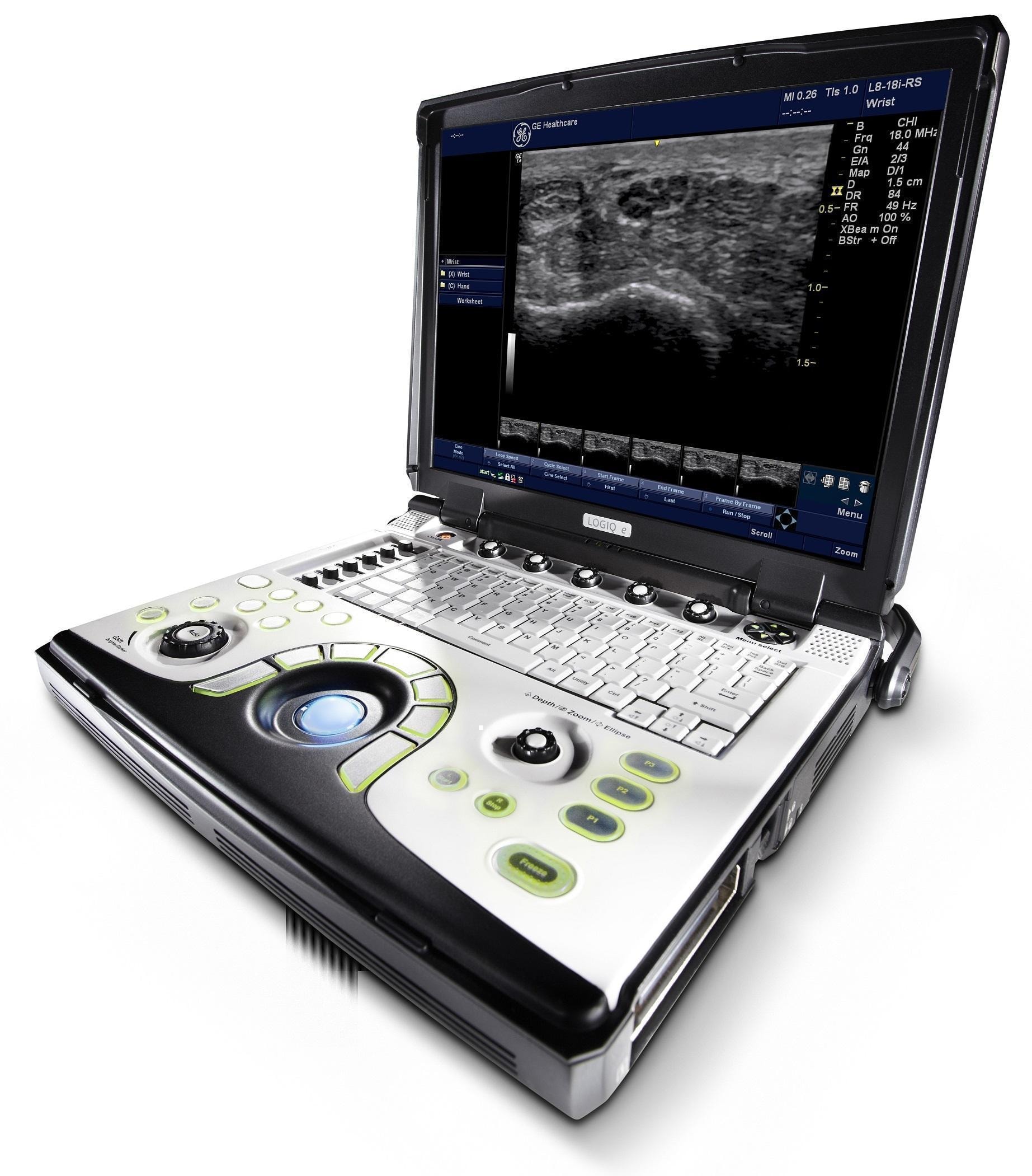 GE HealthCare LOGIQ E