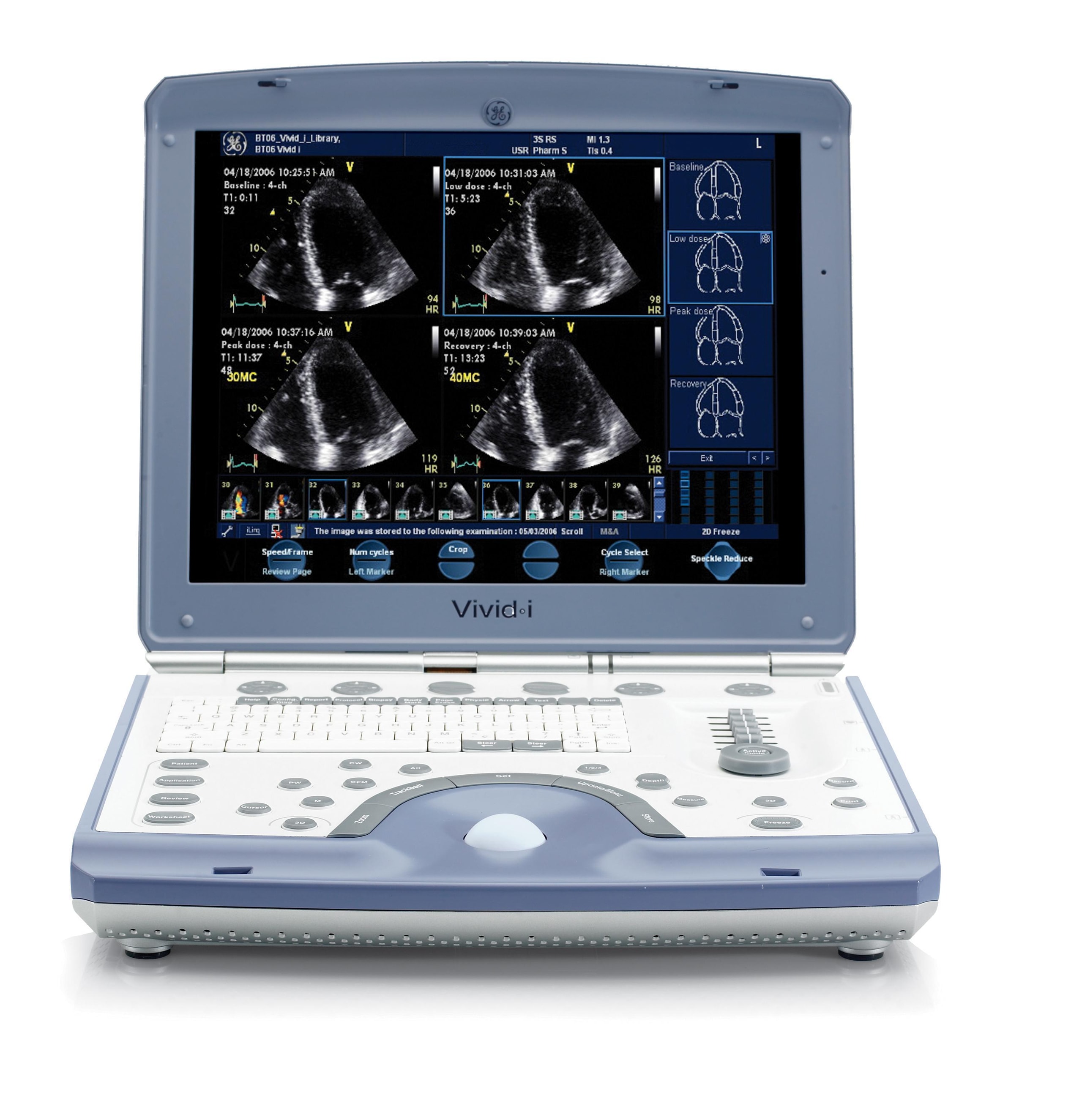 GE HealthCare Vivid I