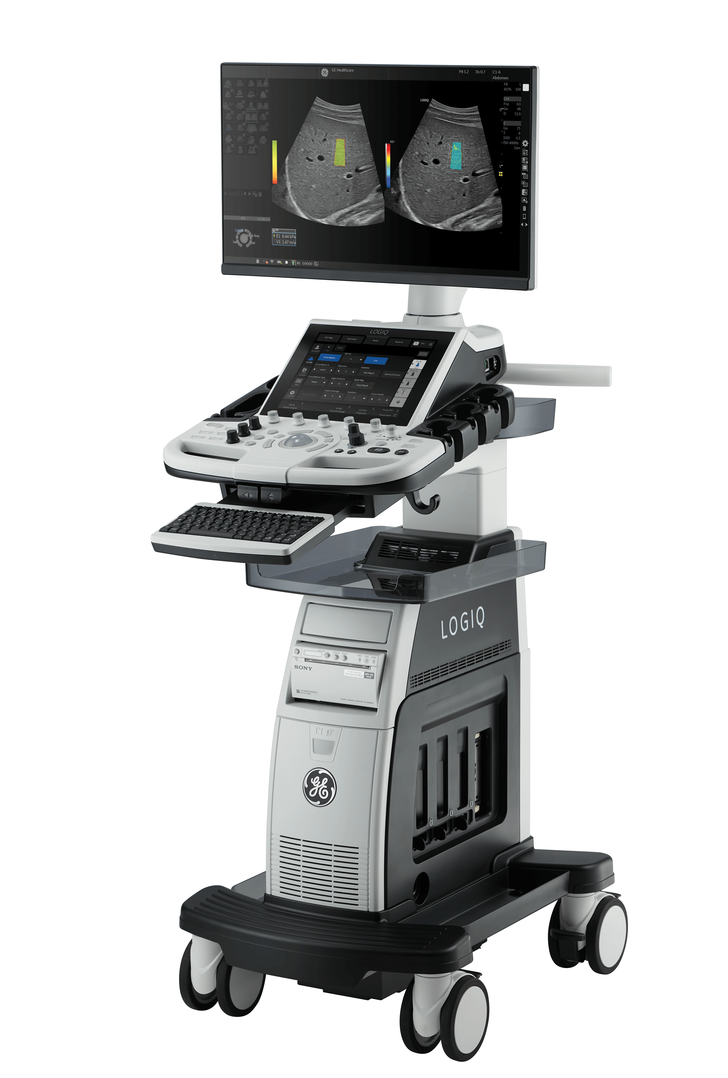 GE HealthCare LOGIQ P10 XDclear