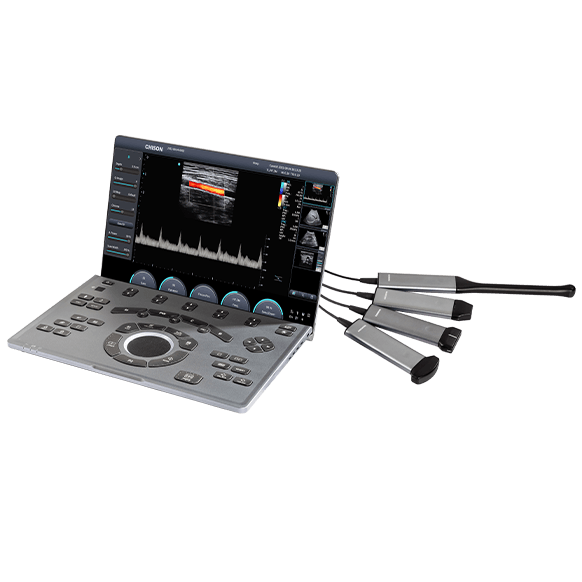 Chison SonoAir 30