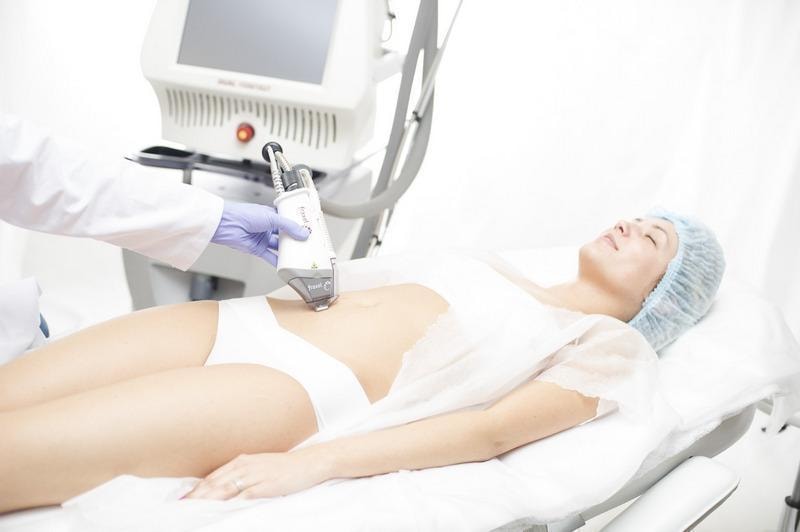 Solta Medical Fraxel DUAL