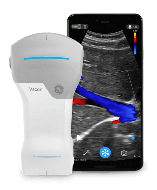 GE HealthCare Vscan AIR — fotografie 1