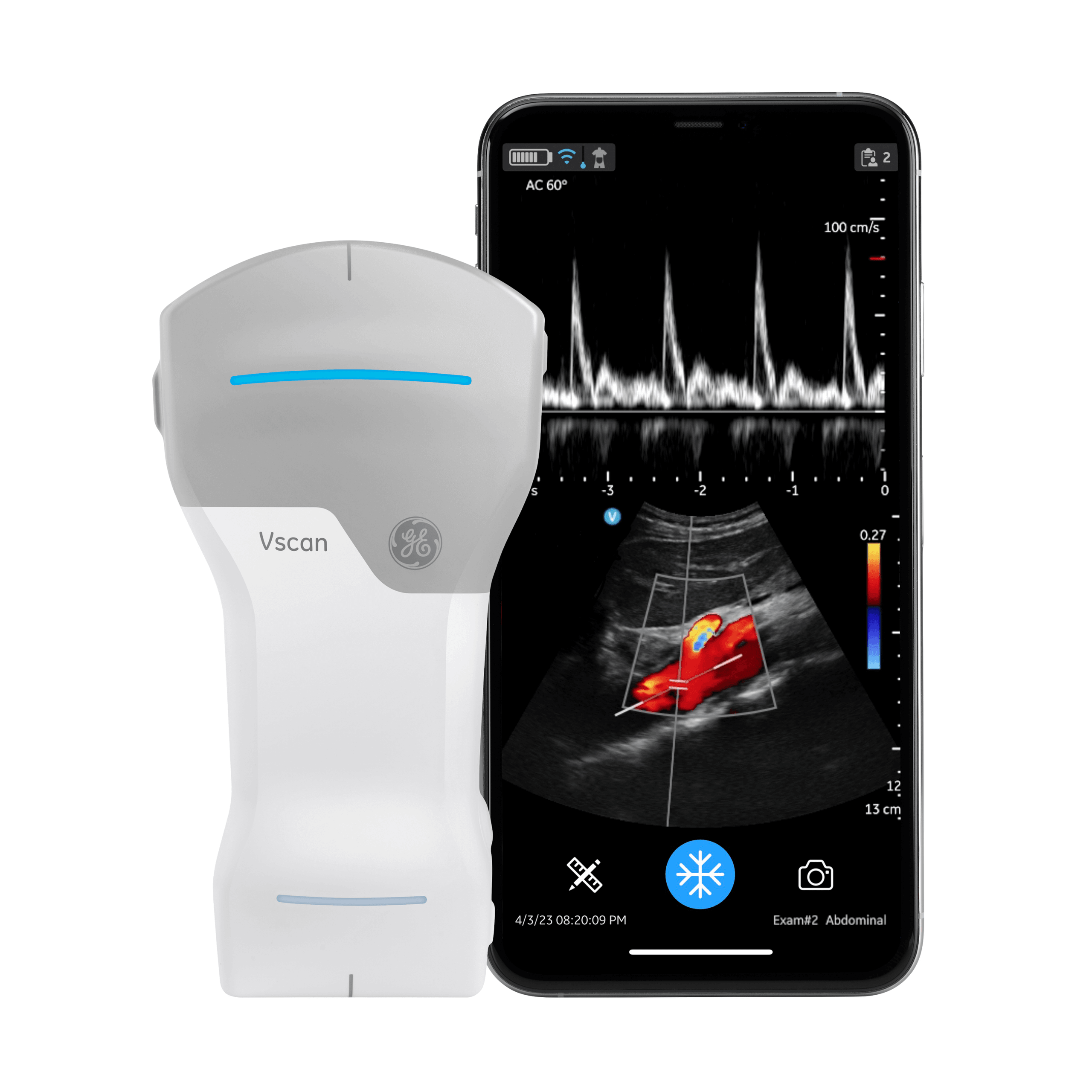 GE HealthCare Vscan Air CL — صورة 1