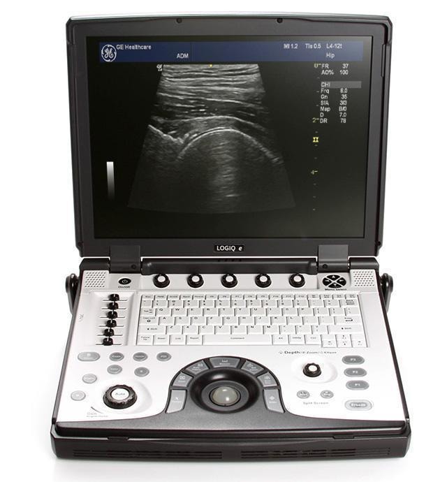 GE HealthCare LOGIQ E — Foto 1