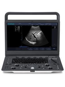 SonoScape E1V Ultrasound Machine
