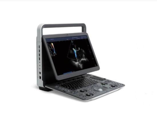 SonoScape E3 Ultrasound Machine