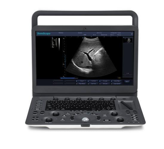 SonoScape E1 Ultrasound Machine