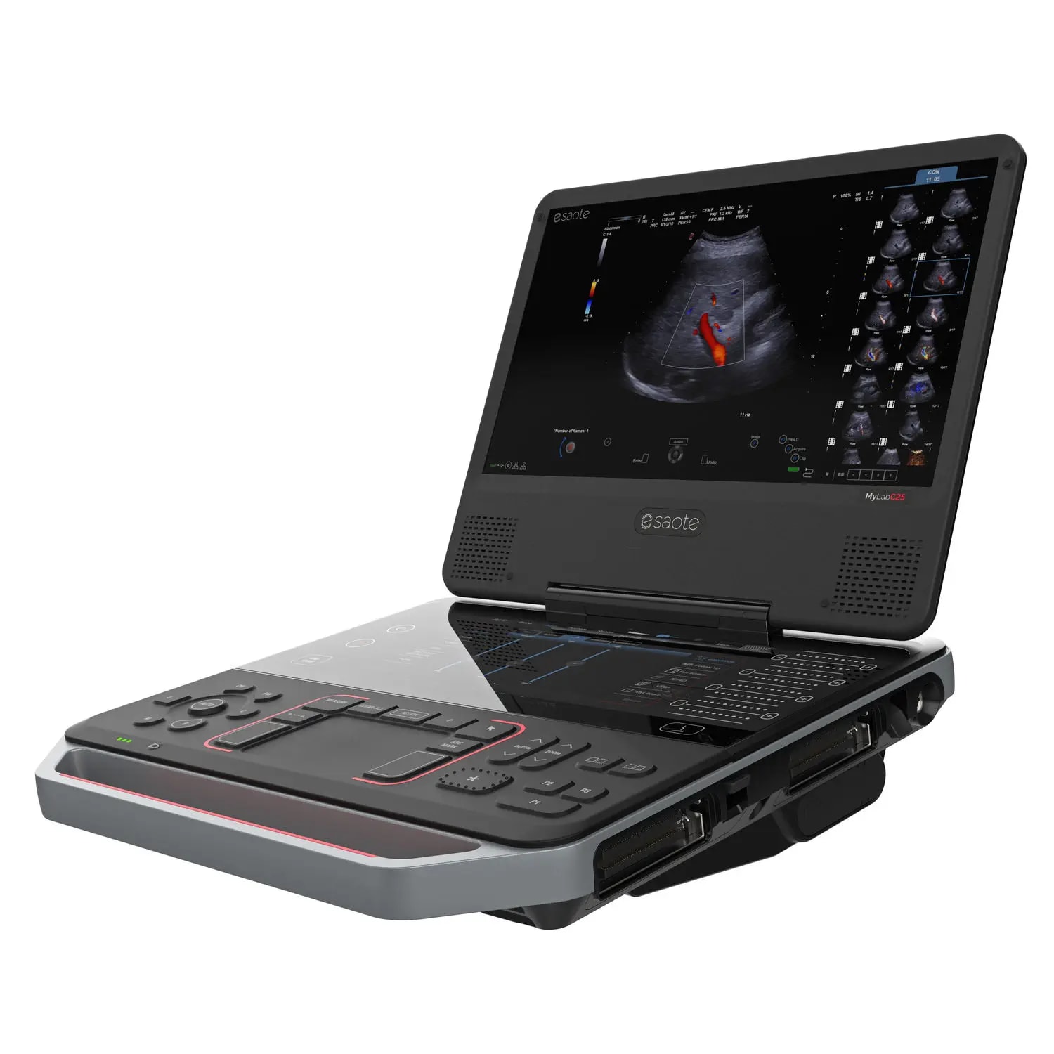 Esaote MyLab C25
