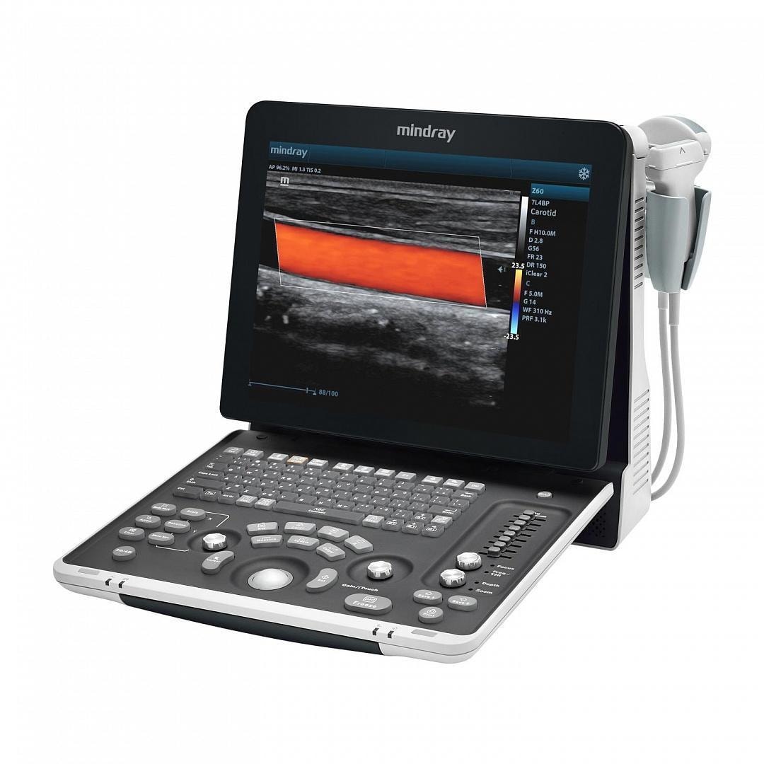 Mindray Z60 Ultrasound Machine