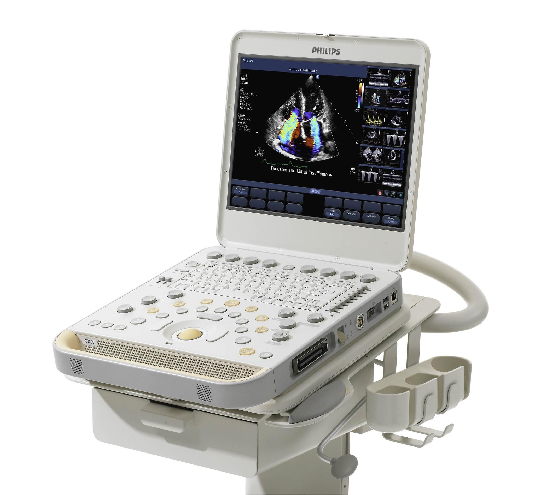 Philips CX50 Ultrasound Machine