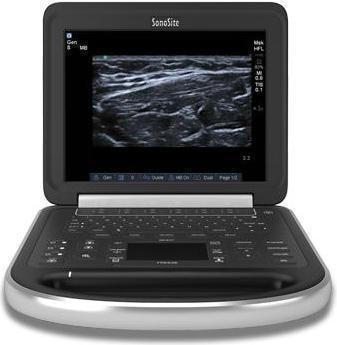 Fujifilm Sonosite Edge