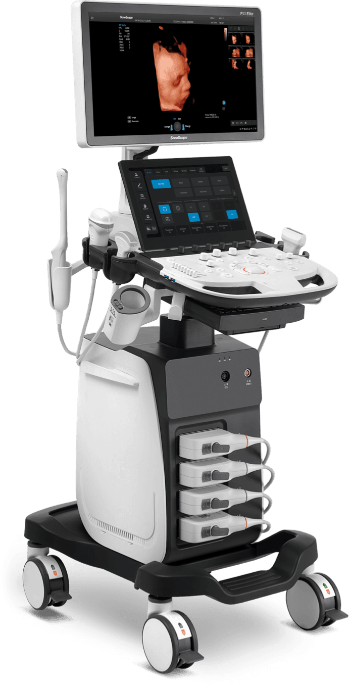 SonoScape P11 Elite Ultrasound Machine