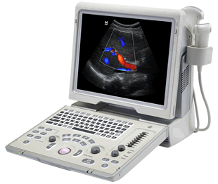 Mindray Z5 Ultrasound Machine