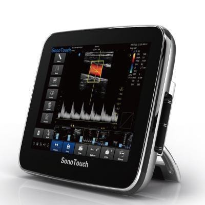 Chison SonoTouch 30