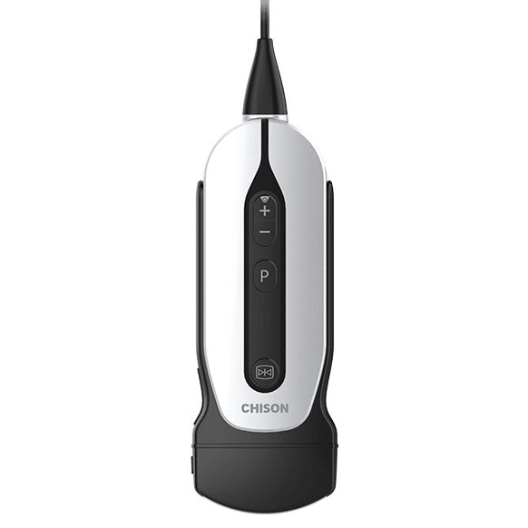 Chison SonoEye P5