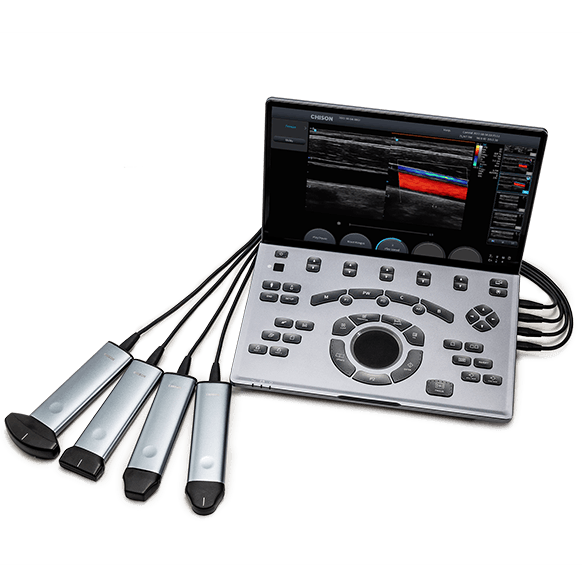 Chison SonoAir 70