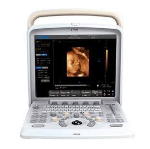 Chison Q5 Ultrasound Machine